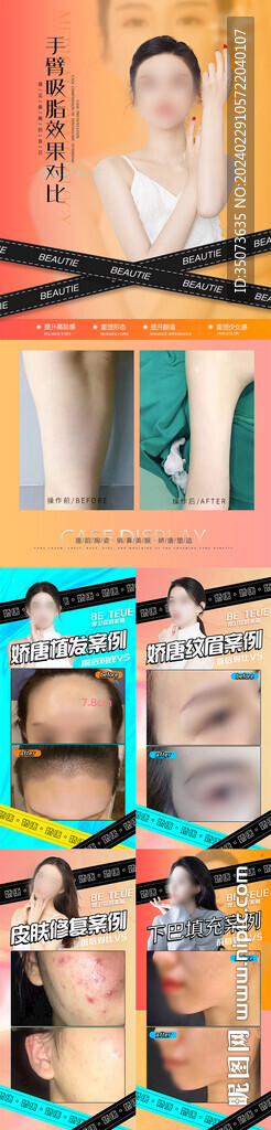 医美案例对比