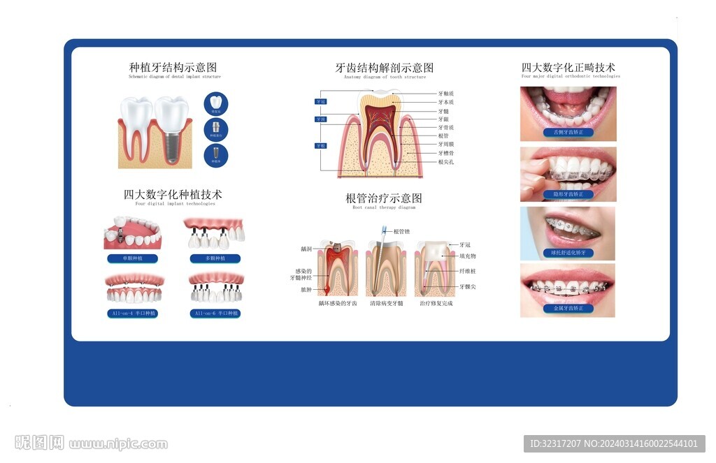 口腔牙齿剖面种植牙科普展板