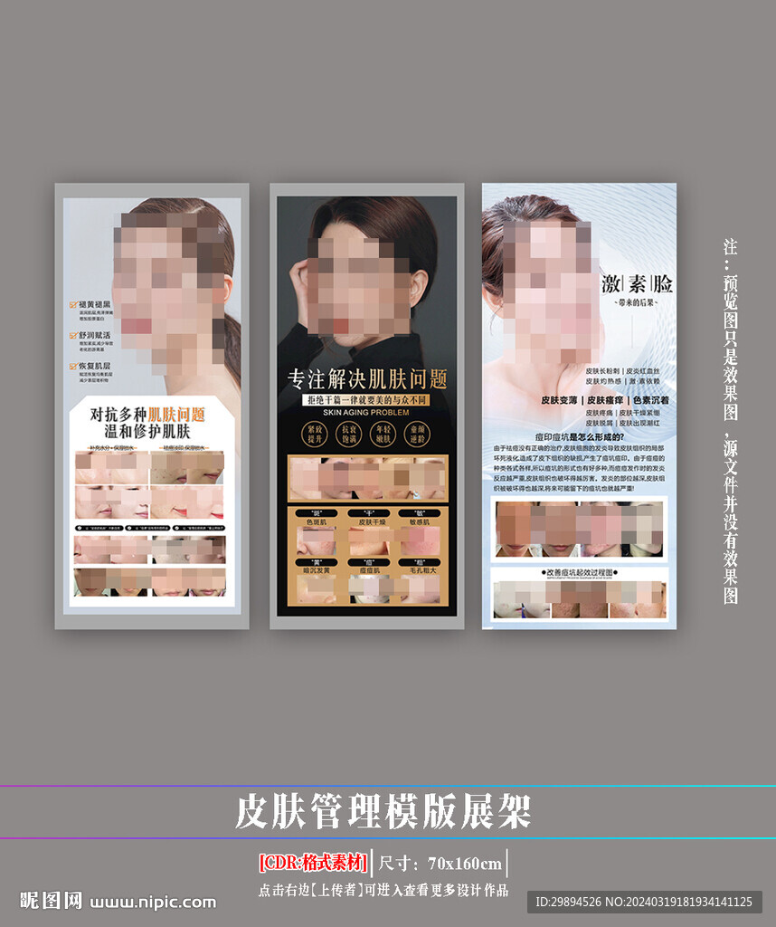 皮肤管理展架 