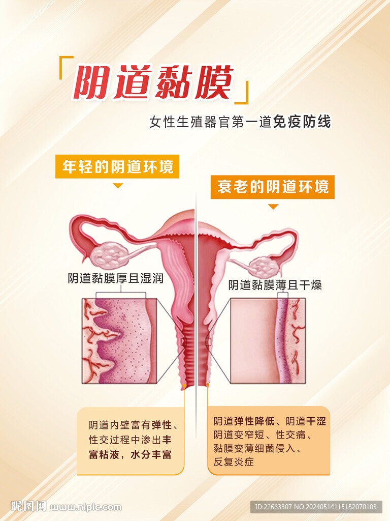 阴道黏膜