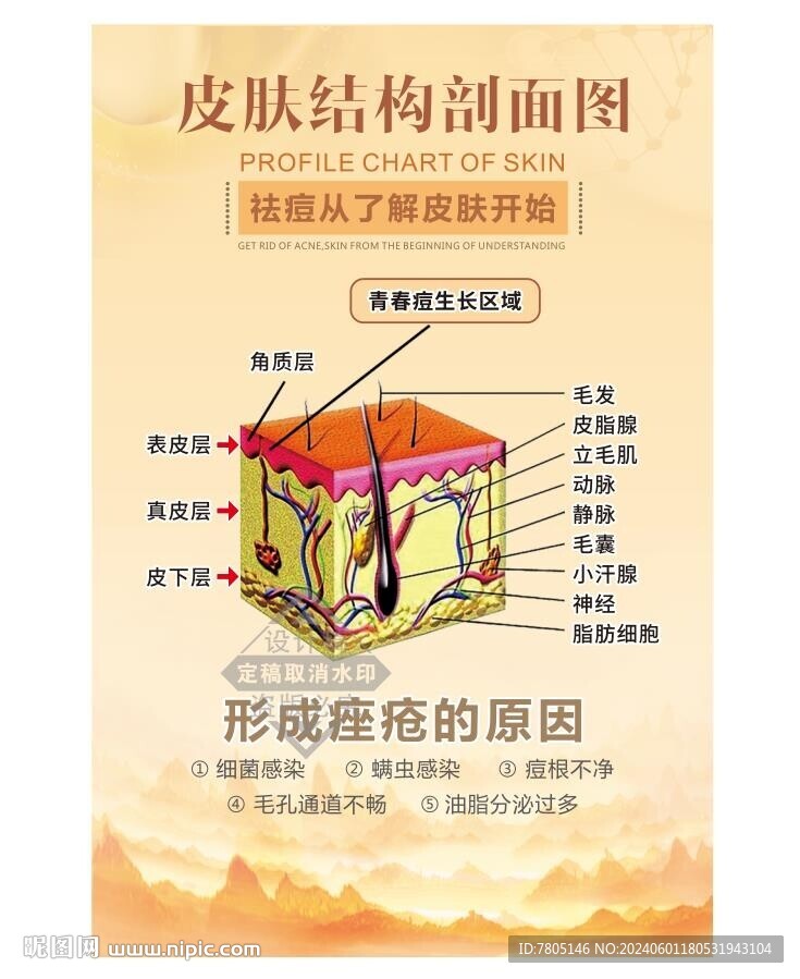 祛痘海报 