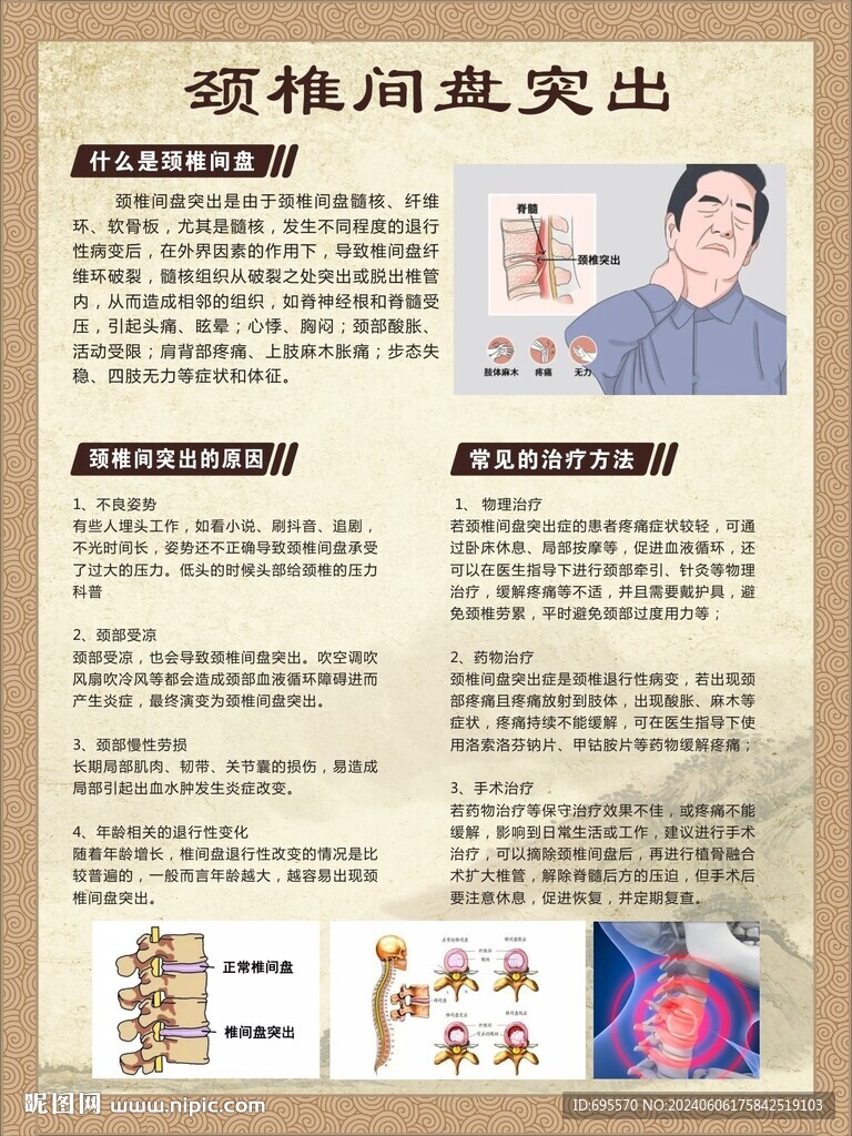 颈椎间盘突出