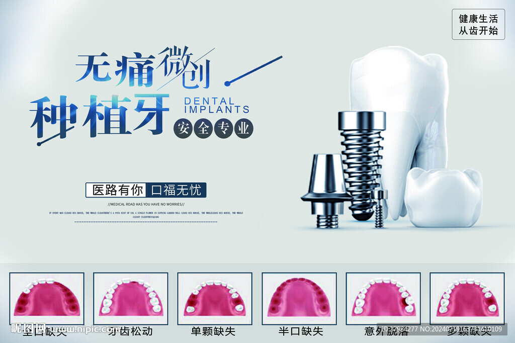 口腔种植