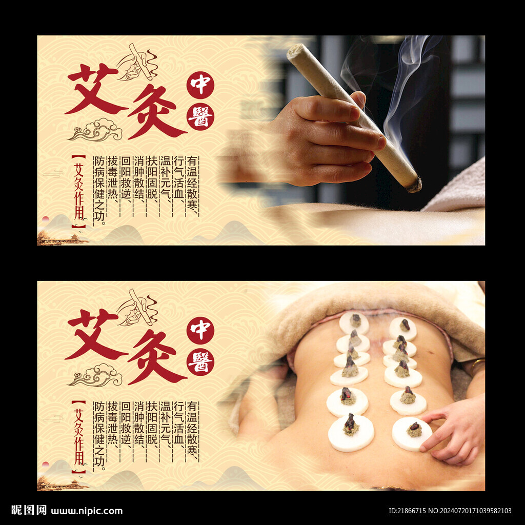 艾灸