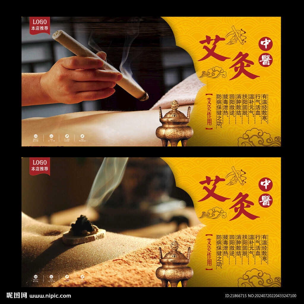 艾灸