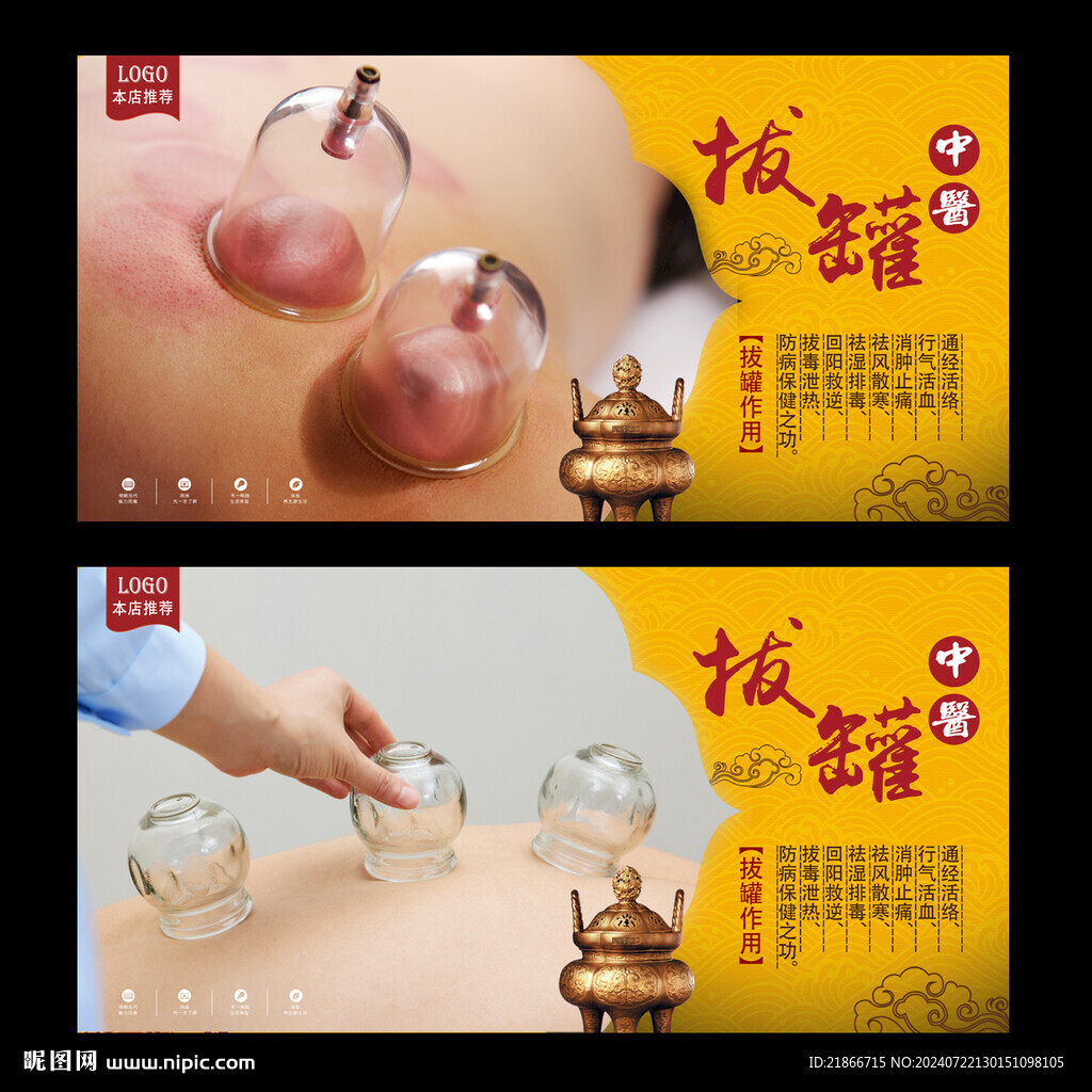 拔罐