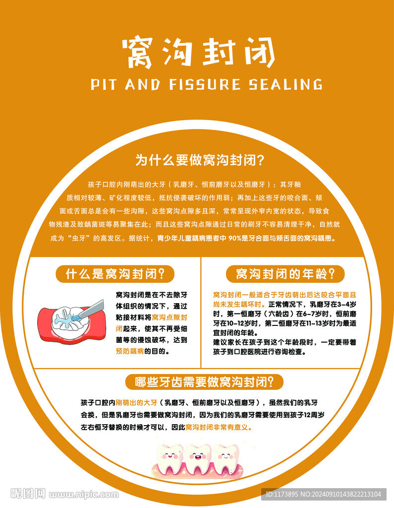 窝沟封闭