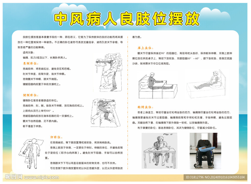 中风病人良肢位摆放