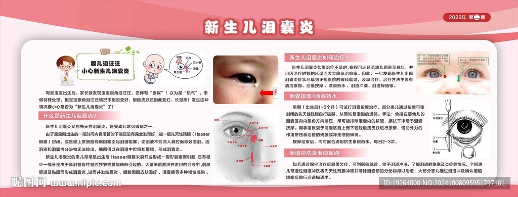 新生儿泪囊炎