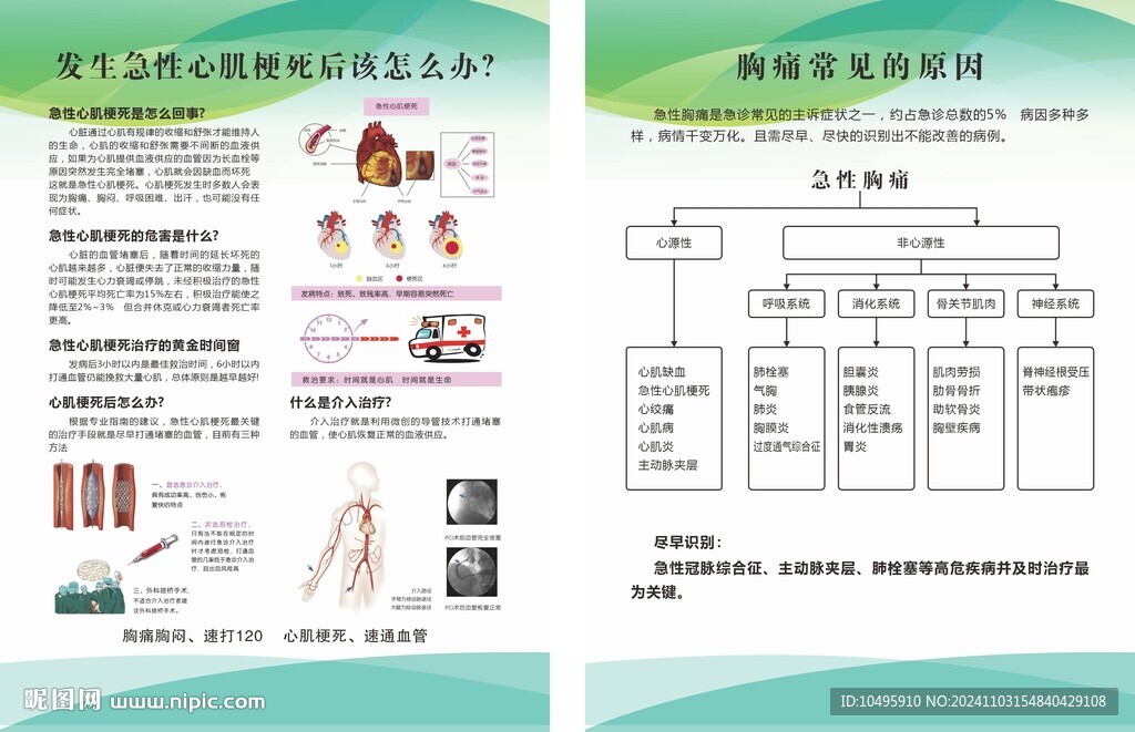 心肌梗塞 急性胸痛