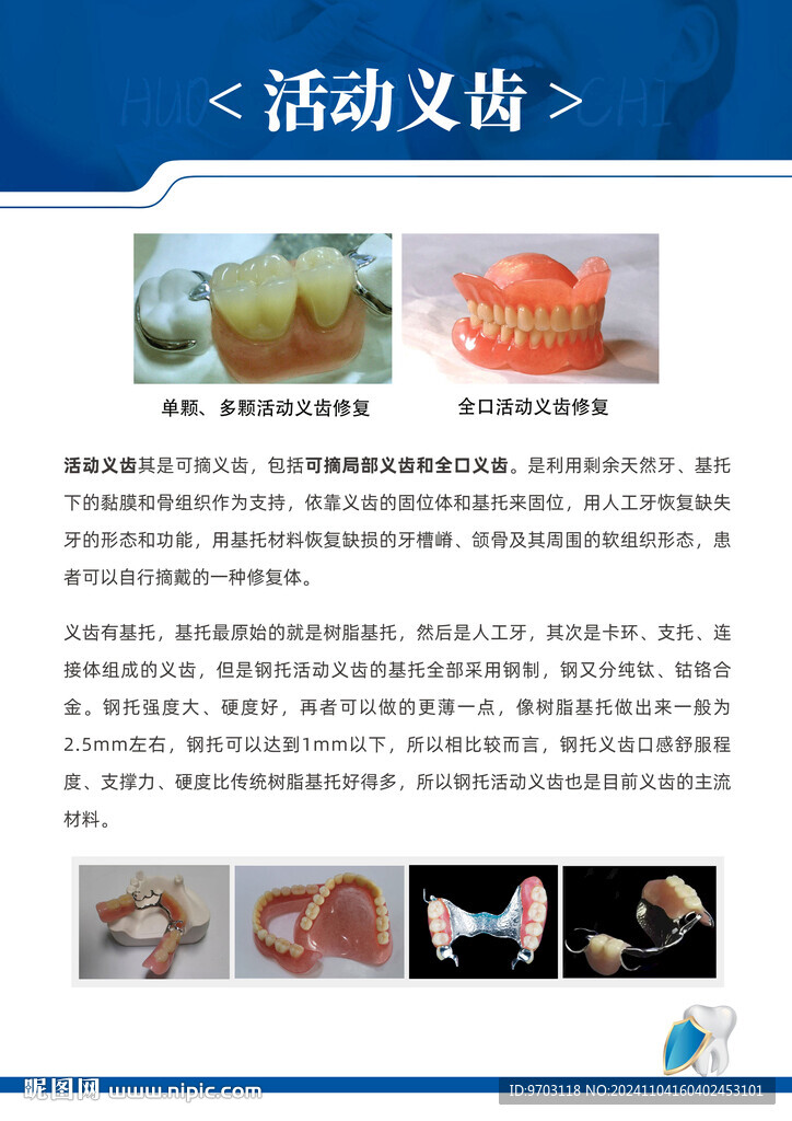 口腔  活动义齿