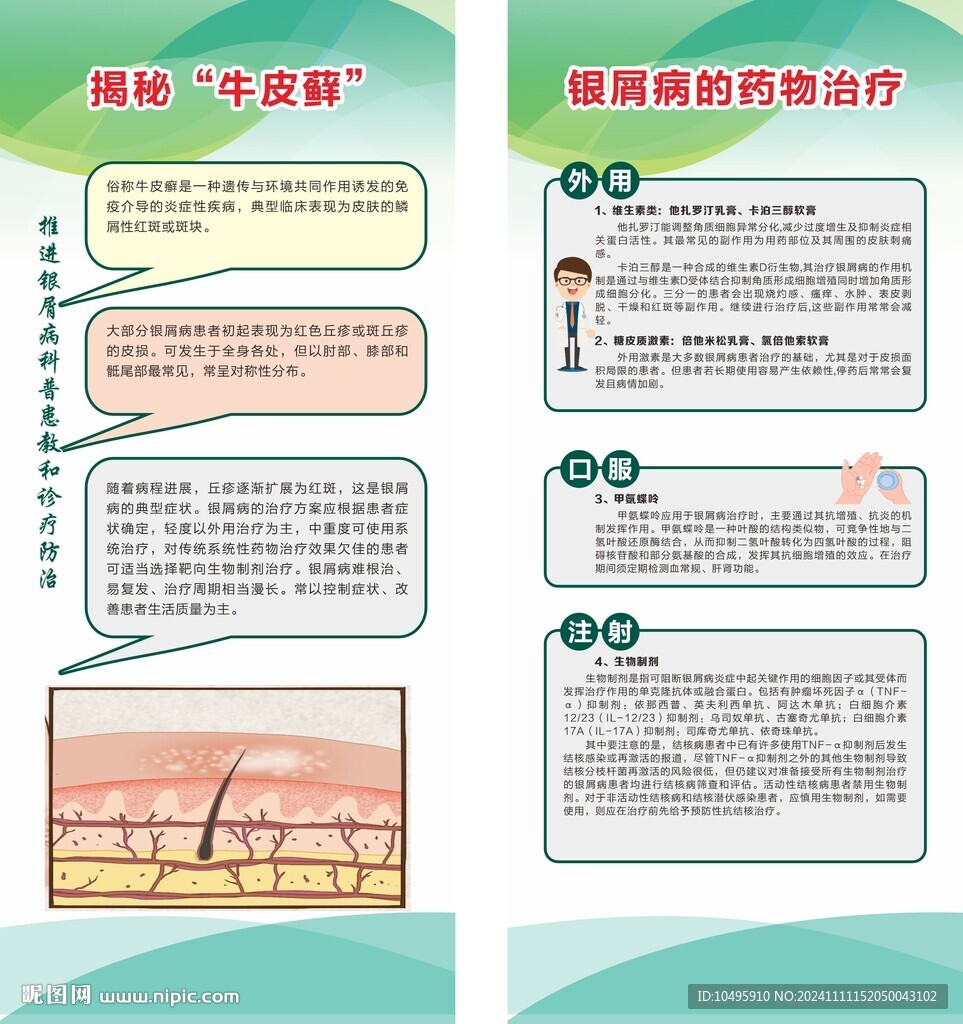 银屑病科普