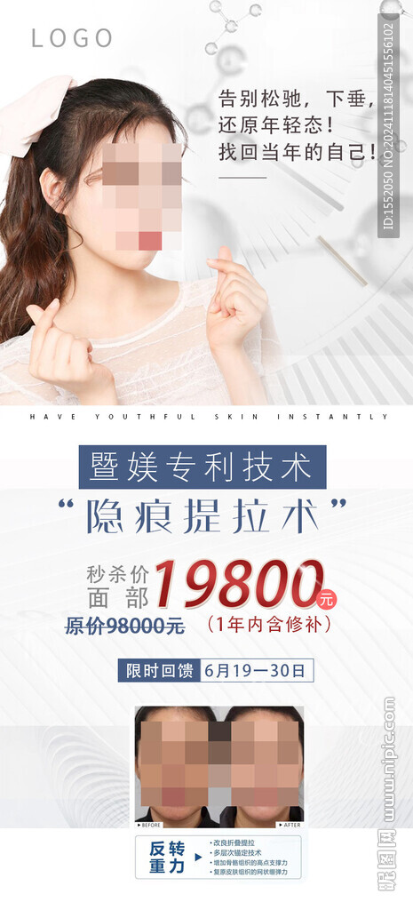 医美卡券