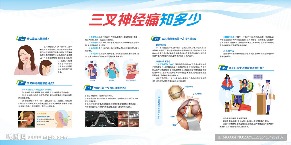 三叉神经