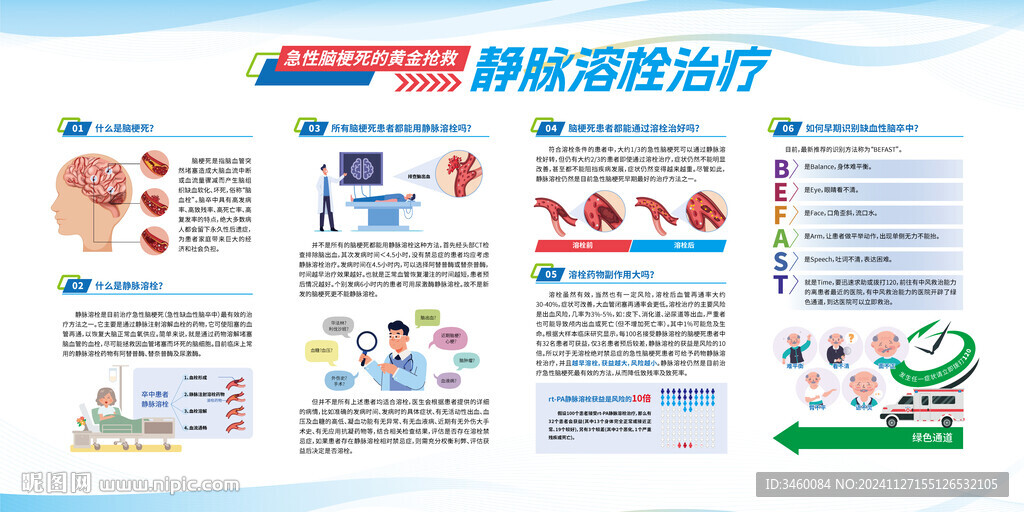 急性脑梗死的黄金抢救静脉溶栓