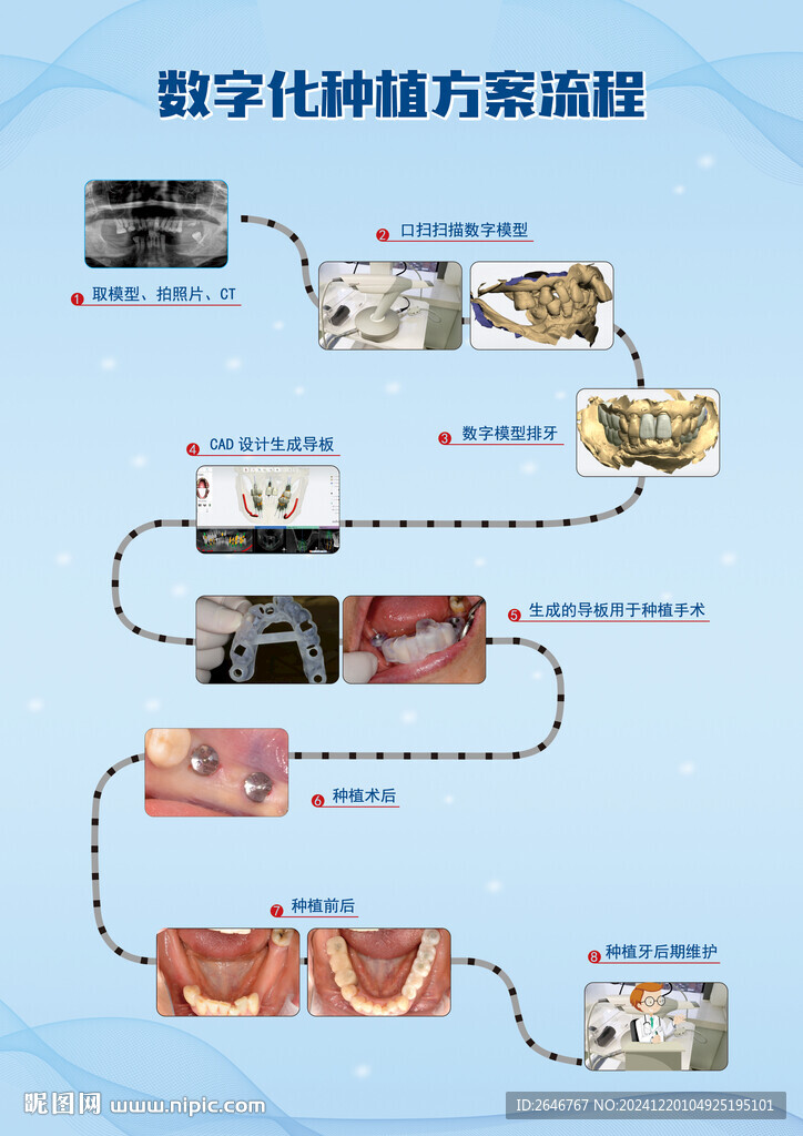 数字化种植方案流程