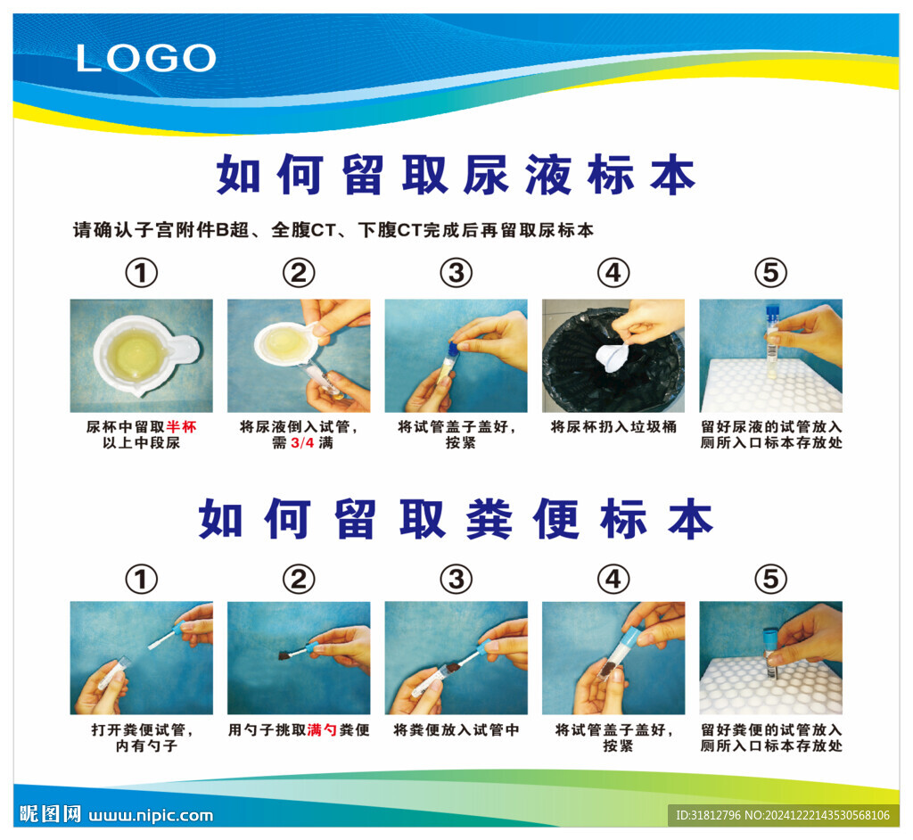 如何留取尿液样本