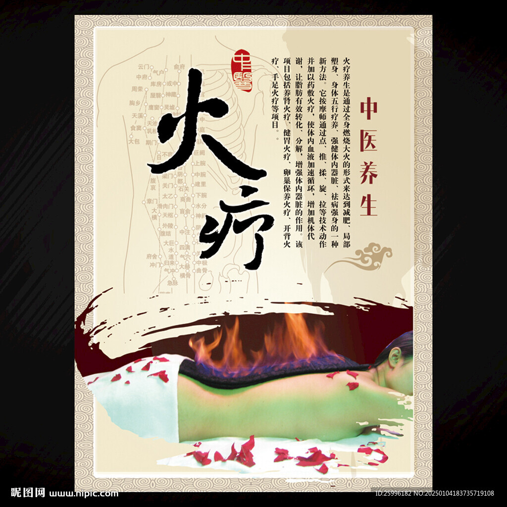 火疗