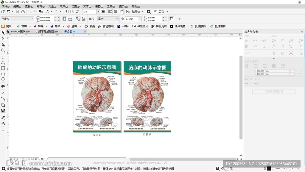 脑底动脉示意图