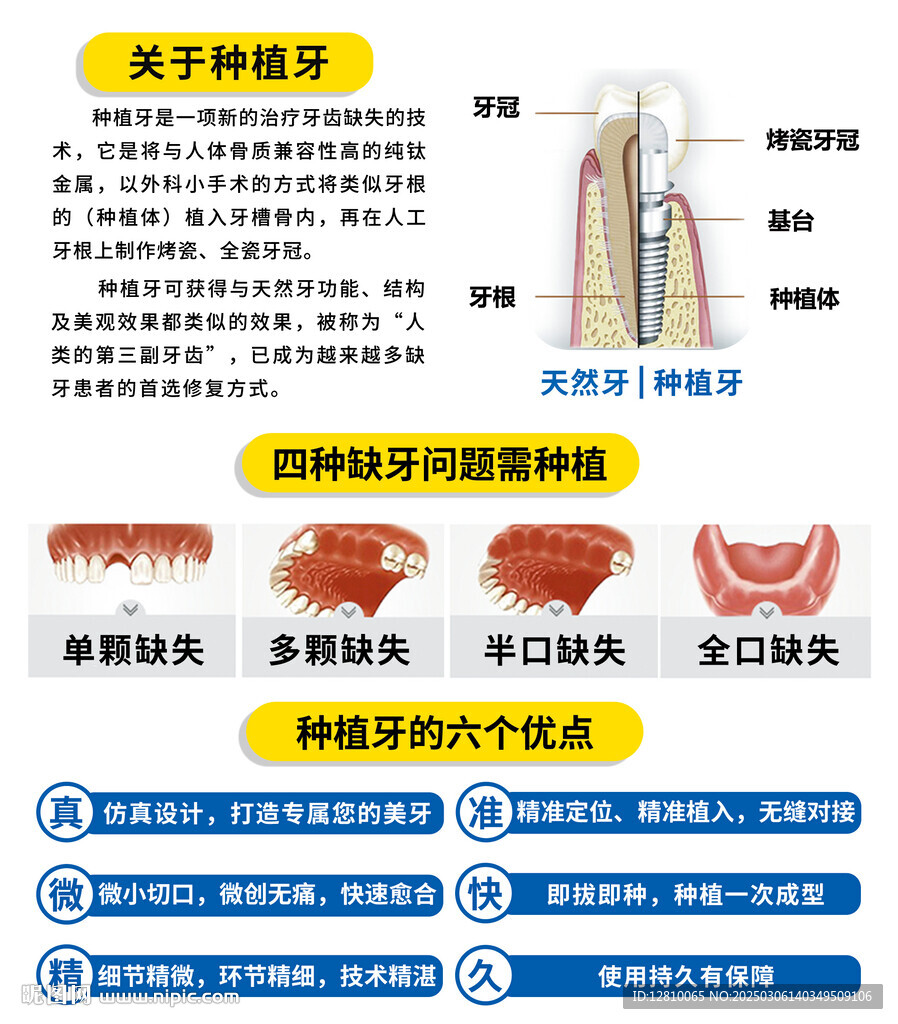 种植牙宣传图