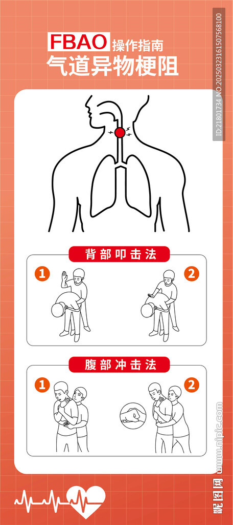 气道异物梗阻