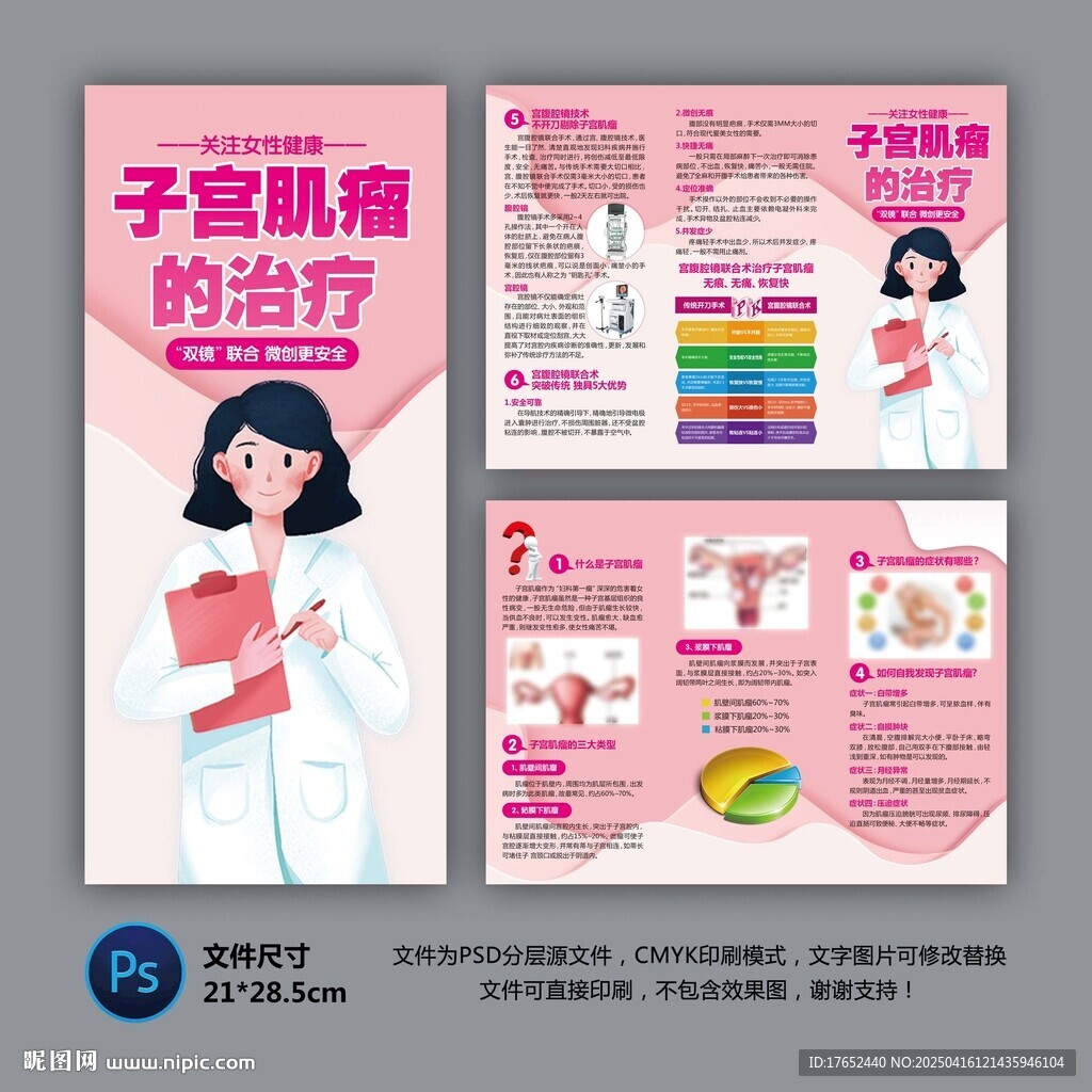 子宫肌瘤的治疗