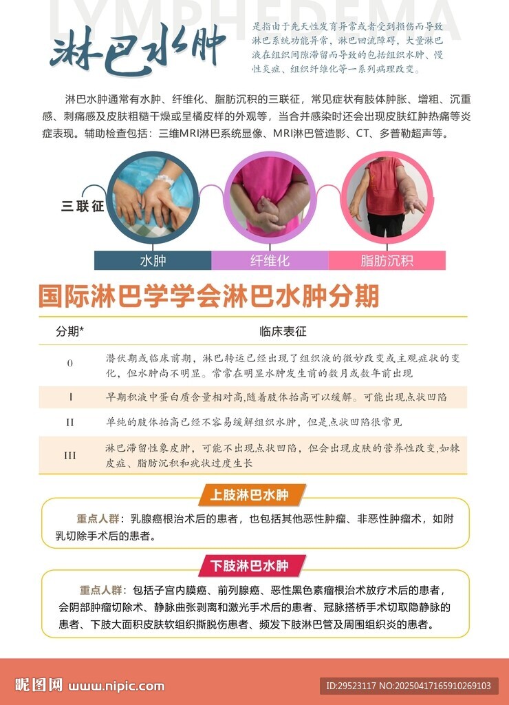 淋巴水肿分期