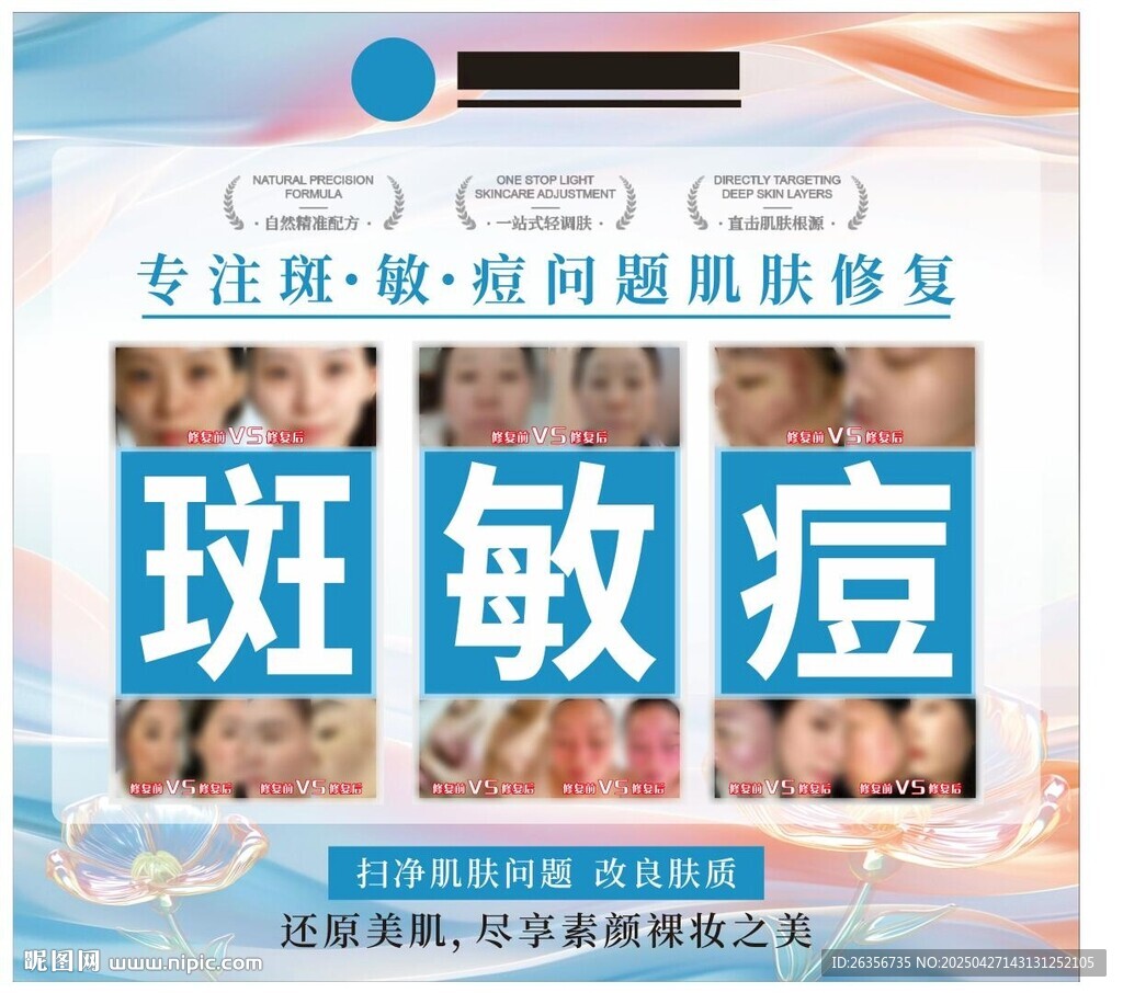 美容祛斑祛痘