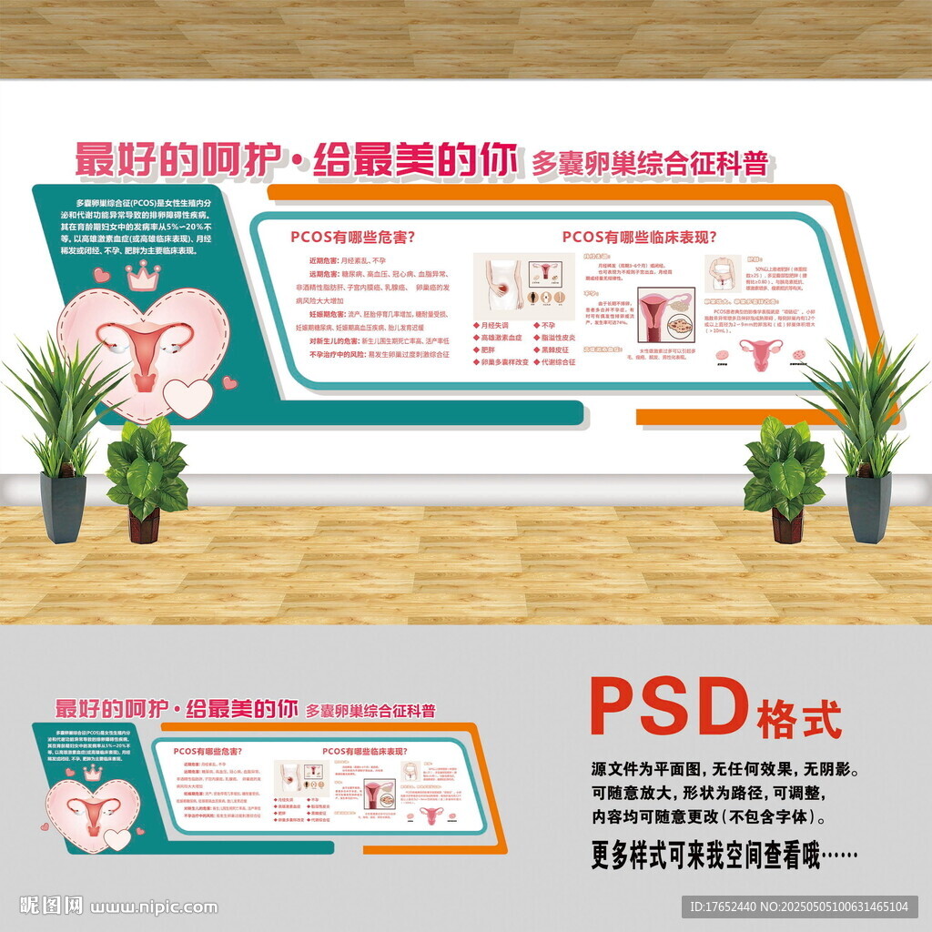 多囊卵巢文化墙