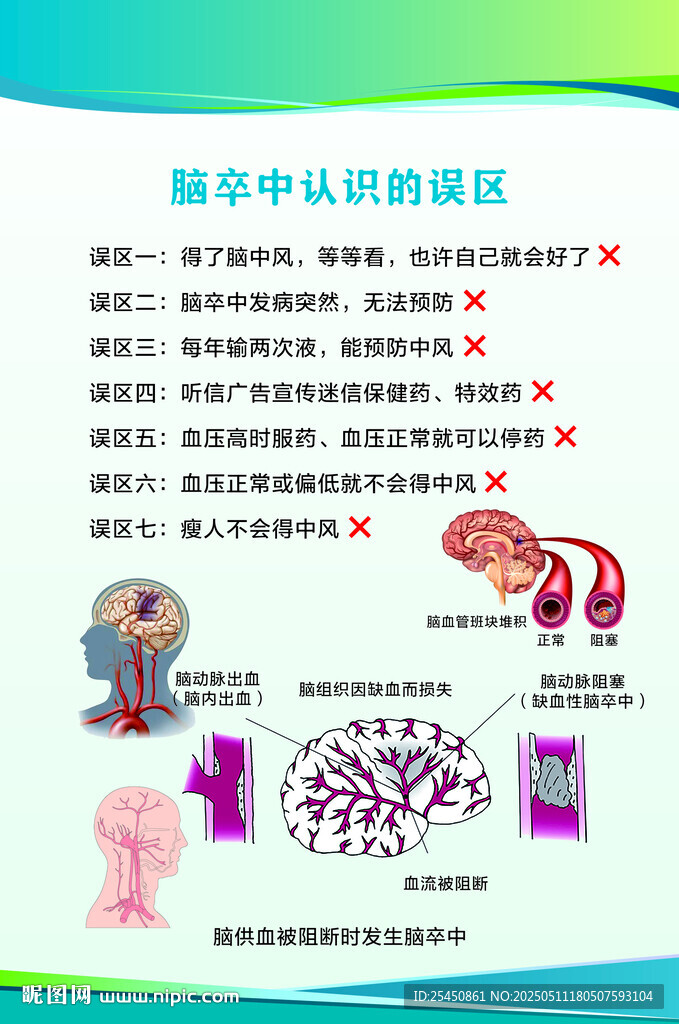 脑卒中认识的误区