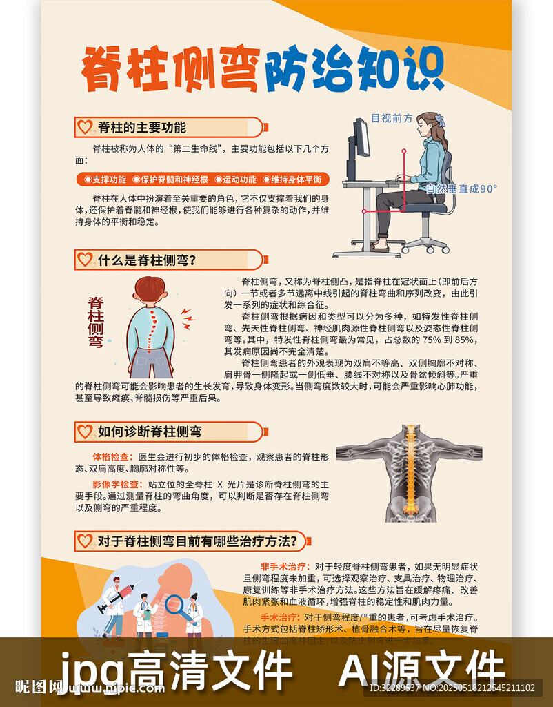 脊柱侧弯防治知识