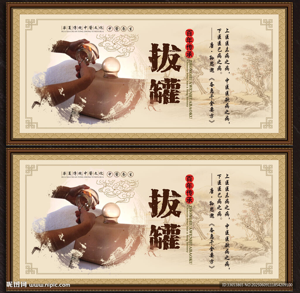 拔罐