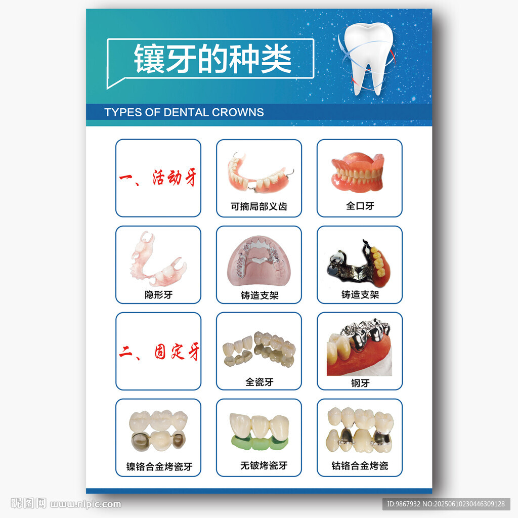 镶牙的种类