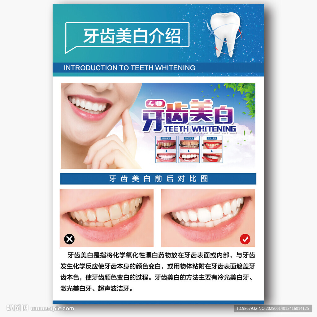 牙齿美白