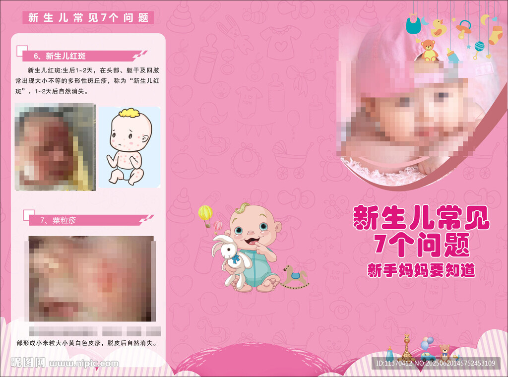 新生儿常见的问题