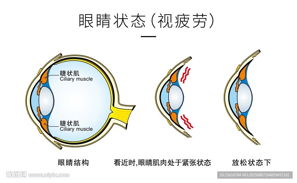 眼球结构图