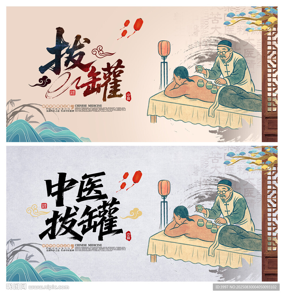 拨罐