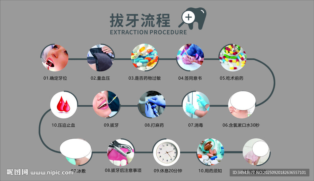 拔牙类流程图示例