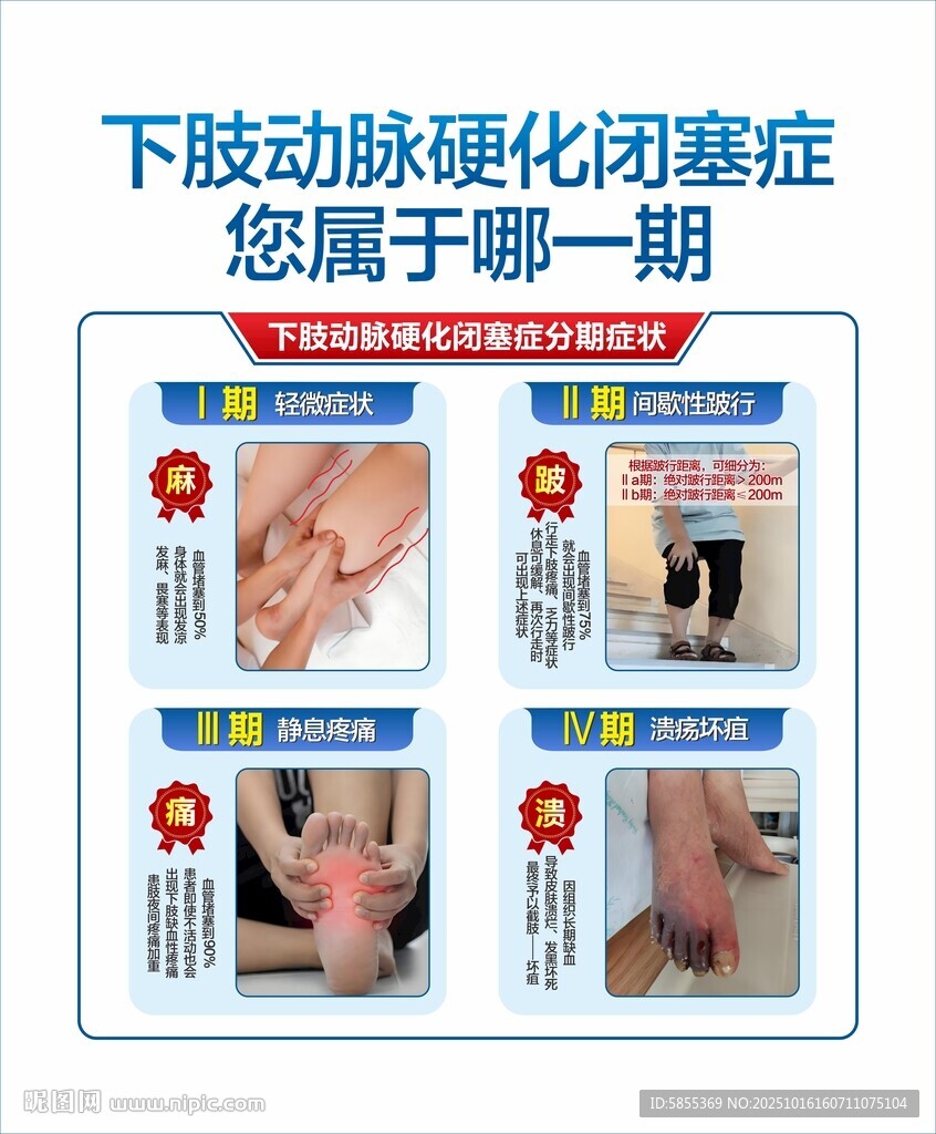 动脉硬化闭赛症