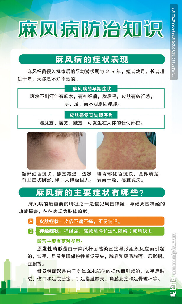 麻风病