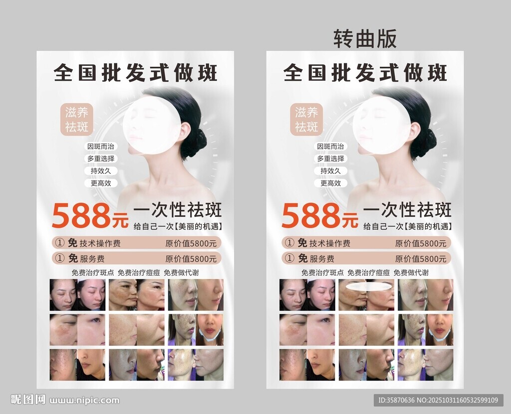 祛斑海报淡斑祛斑对比图