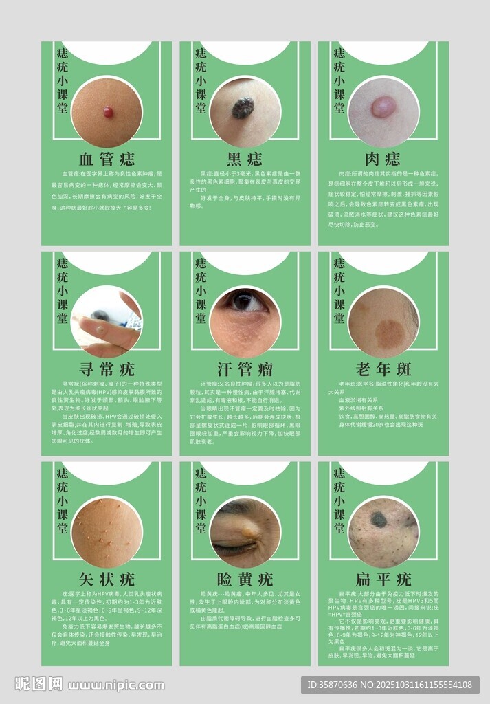 痣疣小课堂集合