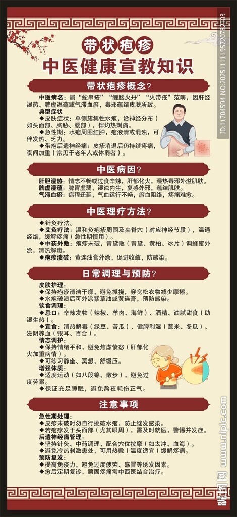 带状疱疹中医健康教育知识展架