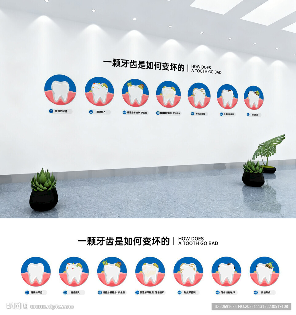 牙齿龋坏过程墙体广告设计