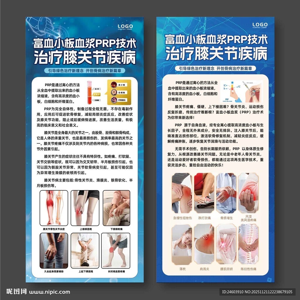富血小板血浆PRP治疗膝关节