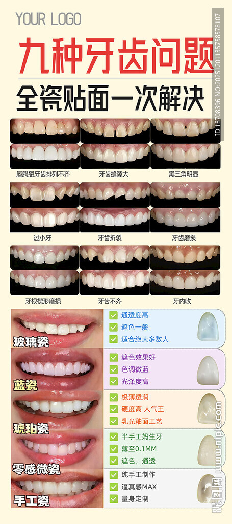 口腔科普牙贴面的九种情况海报