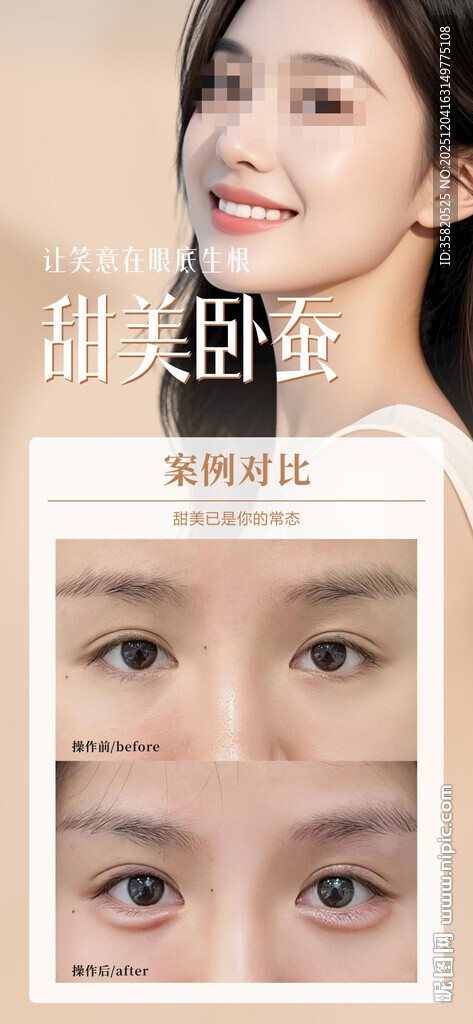 医美案例 卧蚕 面部