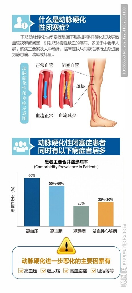 动脉硬化闭赛症