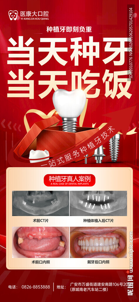 当天种牙当天吃饭优惠活动