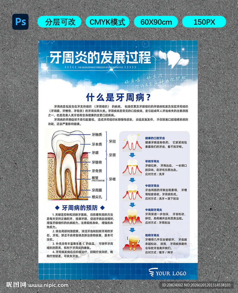 牙周炎的发展过程